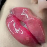 بوتاکس،تزریق ژل،مزوزیرچشم وصورت ،پرسینگ محمدشهر|خدمات آرایشگری و زیبایی|محمدشهر, |دیوار