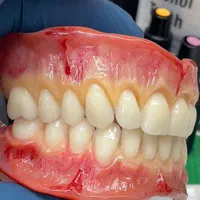 آموزش  دندانسازی مصنوعی به روش جدید.|خدمات آموزشی|شیراز, پارک آزادی|دیوار