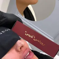 تزریق انواع ژل و بوتاکس مزوتراپی انزیم تراپی|خدمات آرایشگری و زیبایی|تهران, گیشا|دیوار