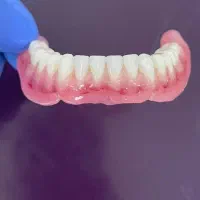 دندانسازی محمدی/طرح کامپوزیت|خدمات آرایشگری و زیبایی|محمدشهر, جعفرآباد|دیوار