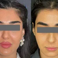 اموزش پزشک متخصص ژل.فیلر‌بوتاکس.لیفت نخ.ساکشن غبغب|خدمات آموزشی|مشهد, سناباد|دیوار