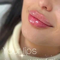 جشنواره تزریق ژل و بوتاکس،فیلرلب،مزو،هایفو،آنزیم