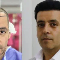 کاشت مو ب روش شیرازی درمشهد|خدمات آرایشگری و زیبایی|مشهد, احمدآباد|دیوار