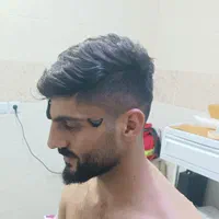 فصد پیشانی ،خالبرداری حجامت ، زالو و بادکش|خدمات آرایشگری و زیبایی|اهواز, کوی مهدیس|دیوار