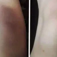 تیرگی پوست|آرایشی، بهداشتی، درمانی|مشهد, چهارباغ|دیوار