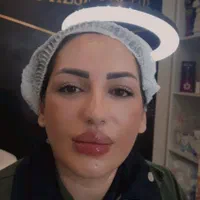 جشنواره تزریق ژل و بوتاکس وفیلر زیر چشم|خدمات آرایشگری و زیبایی|تهران, مرزداران|دیوار