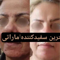 دخترا فروزان رو‌ب اتمام|آرایشی، بهداشتی، درمانی|تهران, هروی|دیوار