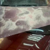 فروش مواد رفع آفتاب سوختگی (کیلر پاک کن)