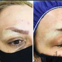 کلینیک پاک کردن تاتو(لیزرتضمینی)دریک جلسه/ریموابرو|خدمات آرایشگری و زیبایی|مشهد, احمدآباد|دیوار