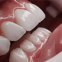 خدمات تخصصی ترمیم دندان