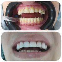 دندانپزشکی حتی در روزهای تعطیل|خدمات آرایشگری و زیبایی|مشهد, کوی ولیعصر|دیوار