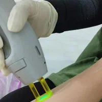 لیزر مو کندلا 2022 (سری شخصی )