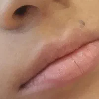 تخفیف ویژه تا ۶ شهریور  فیلربادی سینه بیکینی باسن|خدمات آرایشگری و زیبایی|تهران, دارآباد|دیوار