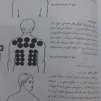 رگ گیری بادکش حجامت زالو و تول گیری|خدمات آرایشگری و زیبایی|تهران, توحید|دیوار