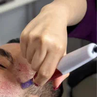 فشیال مزوتراپی مو‌ هیرفیلر پی ار پی prp مزونیدلینگ|خدمات آرایشگری و زیبایی|کرج, مهرویلا جنوبی|دیوار