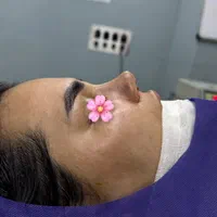 عمل بینی ۲۳ میلیون در تخفیفات|خدمات آرایشگری و زیبایی|تهران, میدان ولیعصر|دیوار