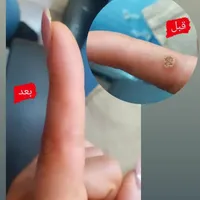 اپیلاسیون دائم،خالبرداری،لیفت ابرو،پارافین تراپی|خدمات آرایشگری و زیبایی|رشت, استقامت 2|دیوار