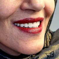 دندانسازی تخصصی (معاینه و مشاوره رایگان)|خدمات آرایشگری و زیبایی|بجنورد, |دیوار