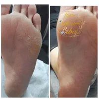 آموزش و خدمات تخصصی پدیکور و ژلیش 2|خدمات آرایشگری و زیبایی|اصفهان, باغ دریاچه|دیوار