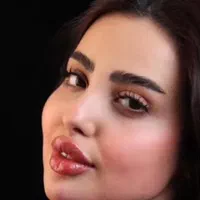 ژل و بوتاکس و لیفت نخ مزوتراپی و آنزیم.فیلربادی|خدمات آرایشگری و زیبایی|کرج, مهرویلا جنوبی|دیوار