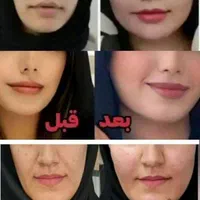 پودر جوانه گندم بین استار (چاقی صورت) اصلی|خوردنی و آشامیدنی|قم, باسکول|دیوار