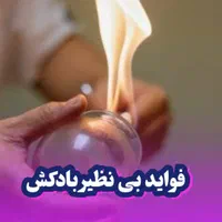 امبدینگ بادکش حجامت طب سوزنی فصد خون زگیل تناسلی|خدمات آرایشگری و زیبایی|اصفهان, باغ زرشک|دیوار