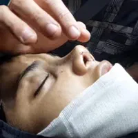 جشنواره جراحی بینی پلک ابدو بلفارو گوش|خدمات آرایشگری و زیبایی|قم, سالاریه|دیوار