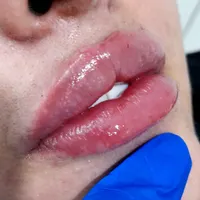 دوره جامع آموزش تزریق ژل،بوتاکس،لیفت نخ وفیلربادی|خدمات آموزشی|شاهین‌شهر, فردوسی|دیوار
