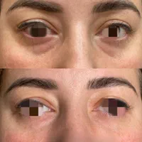 تزریق ژل و بوتاکس تمام ایام حتی روزهای تعطیل|خدمات آرایشگری و زیبایی|فردیس, |دیوار