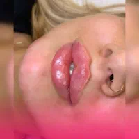 ژل لب / بوتاکس چشم گربه ای / فیلر /مادلینگ|خدمات آرایشگری و زیبایی|کرج, جهان‌شهر|دیوار