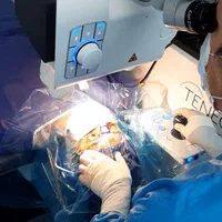 حذف عینک فمتولیزیک لازک ترنسprk