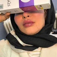 ژل لب بوتاکس لیزر فیلر هایفوبلفاروپلاستی