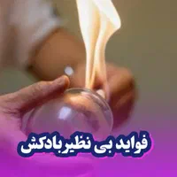امبدینگ موکساتراپی حجامت طب سوزنی بادکش فصد زگیل|خدمات آرایشگری و زیبایی|اصفهان, مسجد مصلی|دیوار