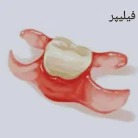 دندان مصنوعی.کامپوزیت.اقساطی(اسلامشهر)|خدمات آرایشگری و زیبایی|اسلام‌شهر, شهرک واوان|دیوار