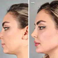 خدمات زیبایی نفس