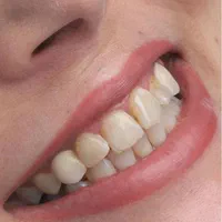 کلینیک دندانپزشکی ایمپلنت ارتودنسی زیبایی درمانی|خدمات آرایشگری و زیبایی|تبریز, |دیوار