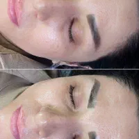 پاکسازی فیشال مزونیدلینگ اسکالپ کربوکسی پلکسر|خدمات آرایشگری و زیبایی|مشهد, رسالت|دیوار
