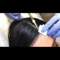 تخصصی پی آر پیprp مزو بوتاکس فیلر ژل حجامت فصد|خدمات آرایشگری و زیبایی|اصفهان, جلفا|دیوار