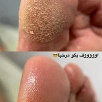 مدل برای پدیکور تضمینی