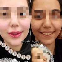 پوست صاف ویکدست میخوای متن آگهی روبخون+پیشنهادویژه|خدمات آرایشگری و زیبایی|قم, باجک دو|دیوار