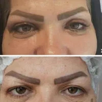 لیپوساکشن شکم و پهلو، ترنسفر به باسن،هایفودابلو|خدمات آرایشگری و زیبایی|اصفهان, دشتستان|دیوار