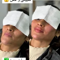 خدمات تخصصی ژل و بوتاکس|خدمات آرایشگری و زیبایی|شاهین‌شهر, فردوسی|دیوار