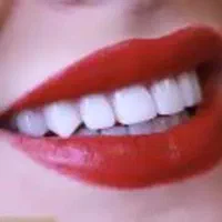 کامپوزیت دندان لمینت ایمپلنت دندانپزشکی عصبکشی|خدمات آرایشگری و زیبایی|شیراز, قصرالدشت|دیوار