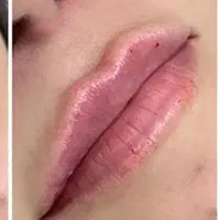 تخفیفات مدل ژل بوتاکس مزو،پاکسازی و جوانسازی صورت|خدمات آرایشگری و زیبایی|مشهد, طلاب|دیوار