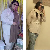 جراحی عمل اسلیومعده/اسلیو معده/چاقی لاغری/اسلیو|خدمات آرایشگری و زیبایی|تهران, چیتگر جنوبی|دیوار
