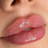 بوتاکس، ژل، چربی، لیزر، هایفوتراپی توسط پزشک