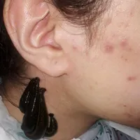 حجامت زالو بادکش فصد،زیبایی بوتاکس ژل لیزر،مامایی|خدمات آرایشگری و زیبایی|اصفهان, باغ دریاچه|دیوار