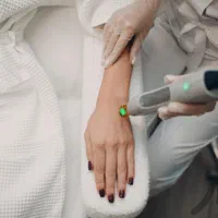 دستگاه لیزر مو الکساندرایت غیرتماسی تاسیس کلینیک