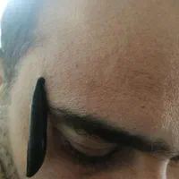 حجامت و زالودرمانی را در منزل خودتان تجربه کنید .|خدمات آرایشگری و زیبایی|اهواز, زیباشهر|دیوار