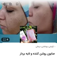 پک اقتصادی ضد لک|آرایشی، بهداشتی، درمانی|قدس, |دیوار